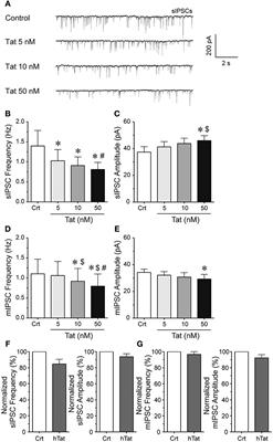 Inhibition of GABAergic Neurotransmission by HIV-1 Tat and Opioid Treatment in the Striatum Involves μ-Opioid Receptors